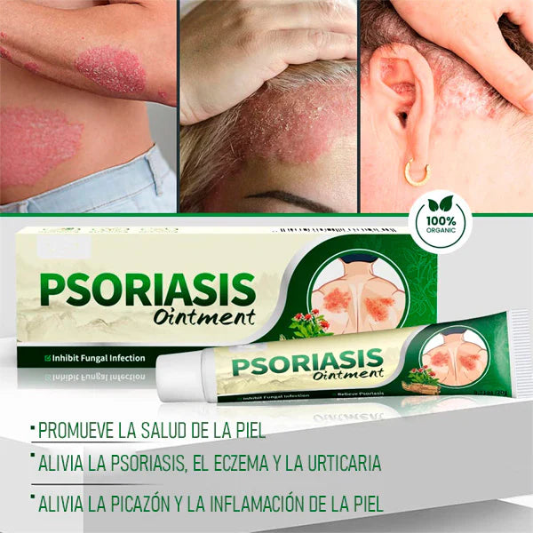 Crema Antifúngica y Antipicazón Jinyue – Tratamiento Natural para Tiña, Hongos y Psoriasis | 20g