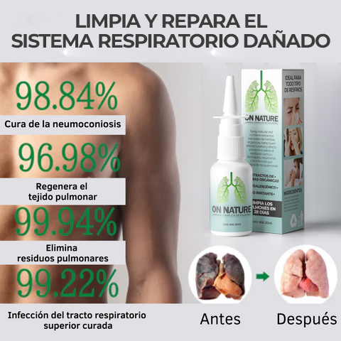 OnNature™ - Spray de limpieza del sistema respiratorio