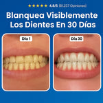 Reparación Odontológica Nudenta – Escudo Dental Avanzado