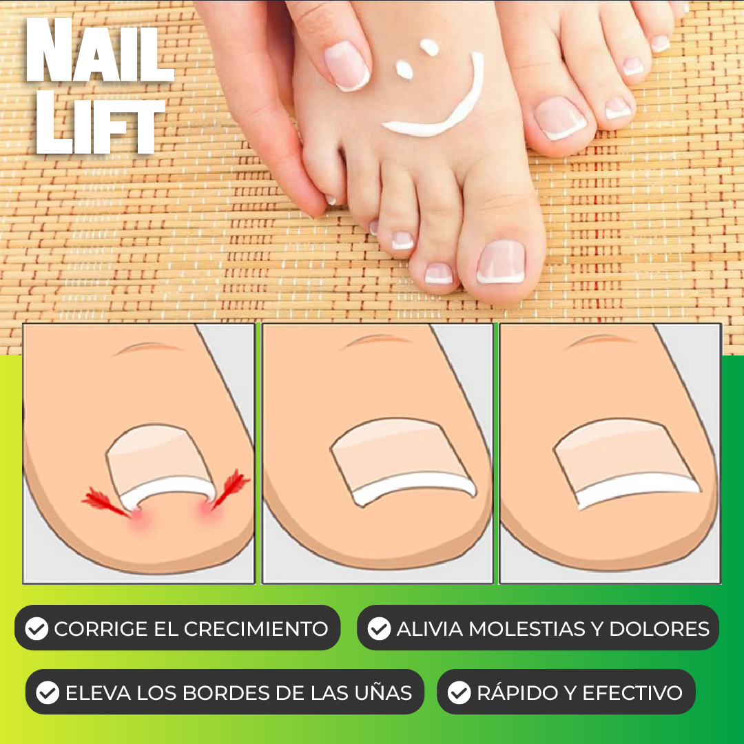 NailLift™ - Parches para Uñas Encarnadas