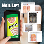 NailLift™ - Parches para Uñas Encarnadas
