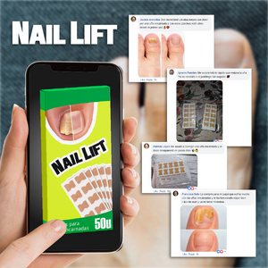 NailLift™ - Parches para Uñas Encarnadas