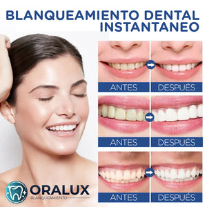 Oralux™ - Tiras Blanqueadoras Dentales