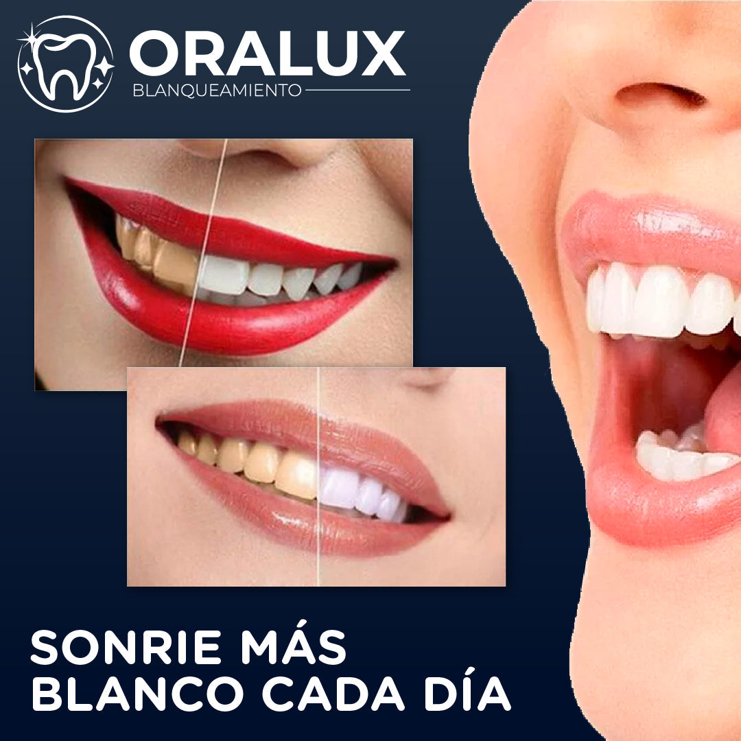 Oralux™ - Tiras Blanqueadoras Dentales