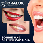 Oralux™ - Tiras Blanqueadoras Dentales