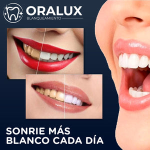 Oralux™ - Tiras Blanqueadoras Dentales
