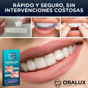 Oralux™ - Tiras Blanqueadoras Dentales