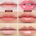 VOLUMINIZADOR DE LABIOS