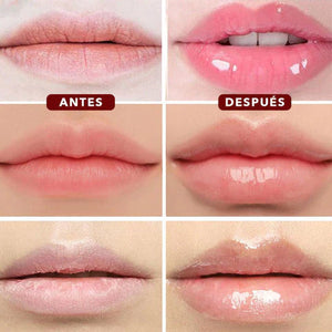 VOLUMINIZADOR DE LABIOS
