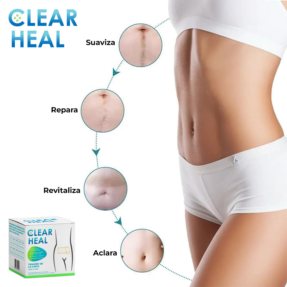 ClearHeal™ - Cinta de silicona para cicatrices
